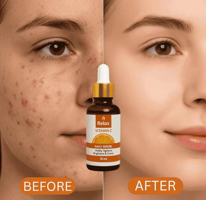 Relax Vitamin C Daily Serum - 30ml | Visibly Brightens, Evens Skin Tone, and Reduces Aging Signs for a Radiant, Youthful Glow